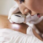 skin-cancer-screening