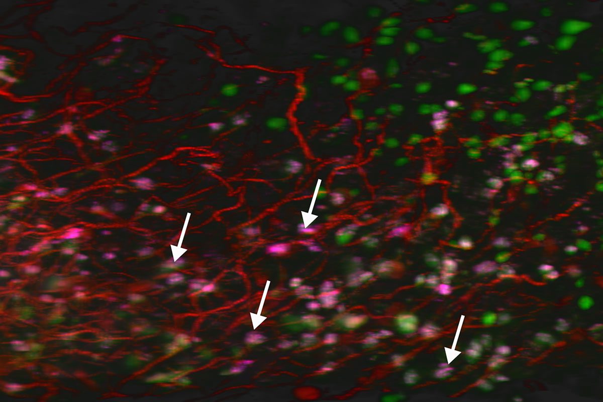 Senescence Stomach Mouse Ding Chen