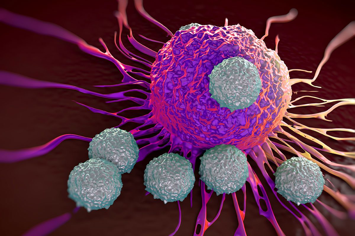 Immunotherapy for head and neck cancer. Shown is an artist's rendering of immune cells (light blue) attacking a cancer cell.