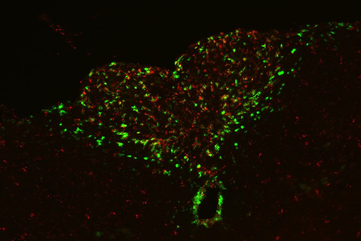 Wild Type Inflammation