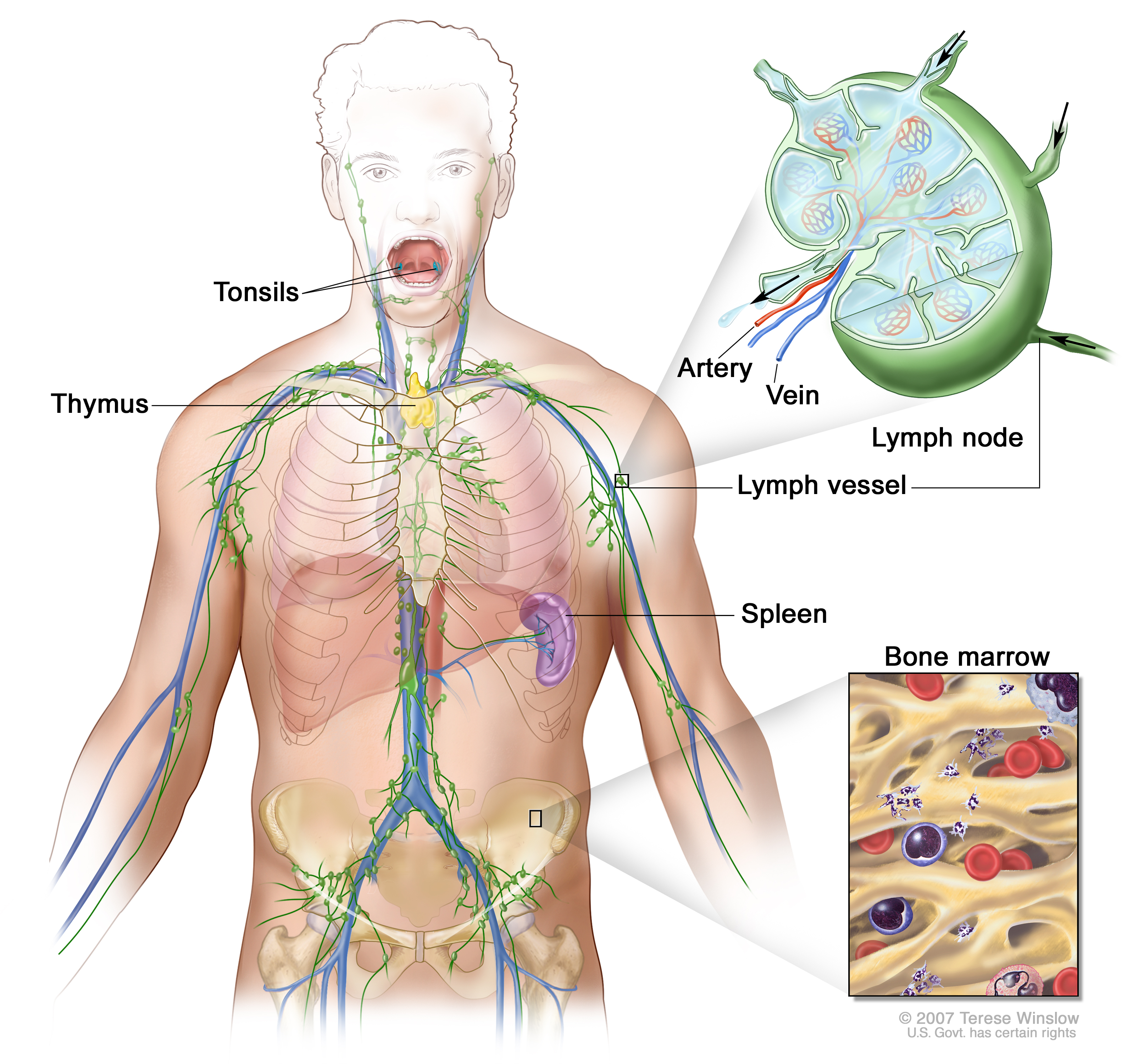aggressive cancer of the lymph nodes